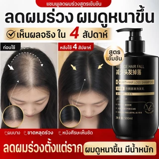 แชมพูขิงแก้ผมร่วง บำรุงรากผม ปรับปรุงสภาพเส้นผม เร่งผมยาว คืนคุณภาพเส้นผม