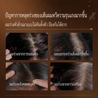 แชมพูขิงบำรุงรากผม ลดผมร่วง เร่งผมยาว ปรับปรุงสภาพเส้นผมที่อ่อนแอ