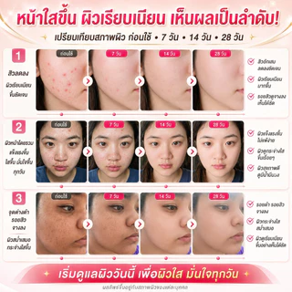LYDIMOON โฟมล้างหน้าไนอะซินาไมด์ 100g ควบคุมความมัน ลดสิว ผิวกระจ่างใส ล้างล้ำลึก ไม่ตึงผิว ใช้ได้ทุกเพศ (COD)