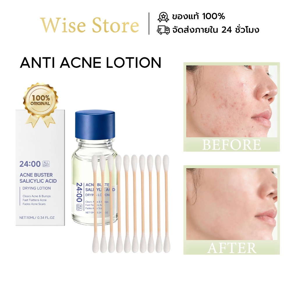 LANISKA Anti Acne Lotion สิว เซรั่ม ลดรอยแดง สิวอักเสบ บำรุงผิวให้ชุ่มชื้น อ่อนโยนต่อผิว