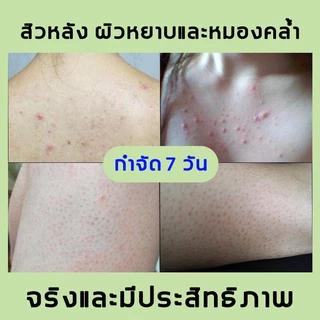 ขาวได้งตัว YZKMSKIN สคับขัดวขาว สครับผิซินาไมด์ ครีมขัดผิวกาย เอกซ์โฟลิเอทติ้ง บอดี้ สครับ สกินสครับผิว สคร