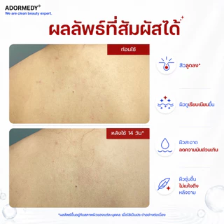 [2 ก้อน] ชาร์โคโลจี สบู่ก้อนสูตรลดสาเหตุการเกิดสิว Charcoalogy Acne Clearing Face and Body Clay Soap
