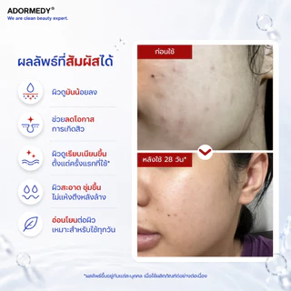ชาร์โคโลจีโคลนล้างหน้าถ่านไม้ไผ่ คุมมัน ลดสิว Charcoalogy Anti-Shine Pore Purifying Clay Cleanser