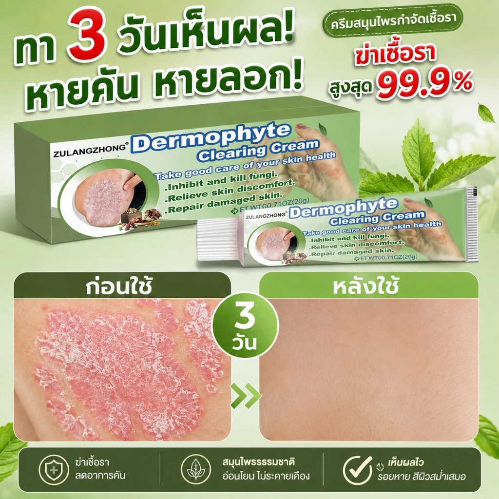 ครีมทาสังคัง สะเก็ดเงินครีม ครีมบำรุงผิว 20g รอยแดง โรคผิวหนัง เกลื้อน กลาก คัน สมุนไพร แก้คันเรื้อรัง คันในร่มผ้า