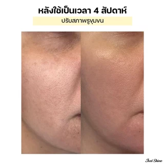 Set X2 Retinal ต่อต้านริ้วรอย ฟื้นฟูผิวให้ลดเลือนริ้วรอย ยกกระชับผิว เพิ่มความยืดหยุ่น