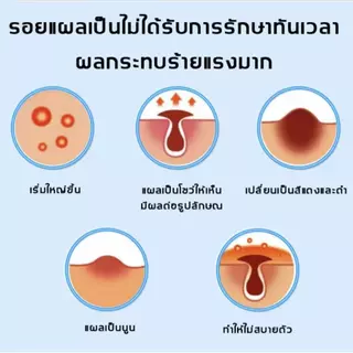 ซื้อ 2 แถม 1 ยาทาแผลเป็น เจลกู้ผิว ทาแผลเป็น ลดรอยแผลเป็น ยาลดรอยแผลเป็น ลบรอยแผลเป็น ครีมแผลเป็น น้ำร้อนลวก รอยสิว 15g