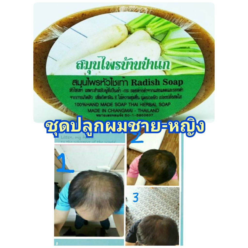 ชุดปลูกผมสำหรับผู้ชาย-ผู้หญิง