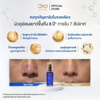 Box Nadora serum 5 ml 6 ซอง นวัตกรรมย้อนวัย REJUVENAD™ เพื่อผิวดูอ่อนเยาว์ ผิวอิ่มฟู เรียบเนียน กระจ่างใส