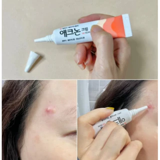 (🌼แท้ / พร้อมส่ง🌼) DONG-A PHARM Acnon Cream 13 g #แต้มสิว [ กล่องมีโลโก้บวก ]