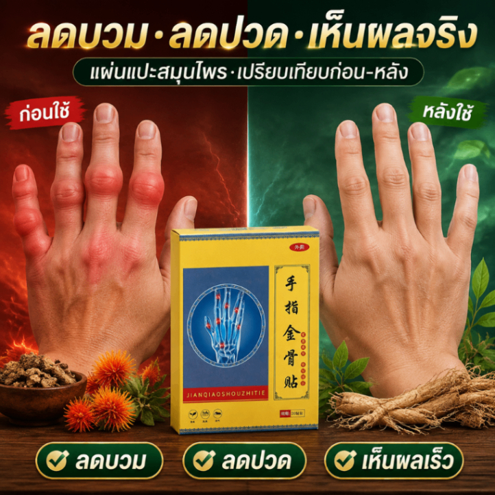 【ผลิตภัณฑ์เพื่อสุขภาพ】แผ่นแปะร้อนช่วยบรรเทาอาการปวดข้อนิ้วมือและข้อต่อ 20 แผ่น ใช้ได้ทุกวัน