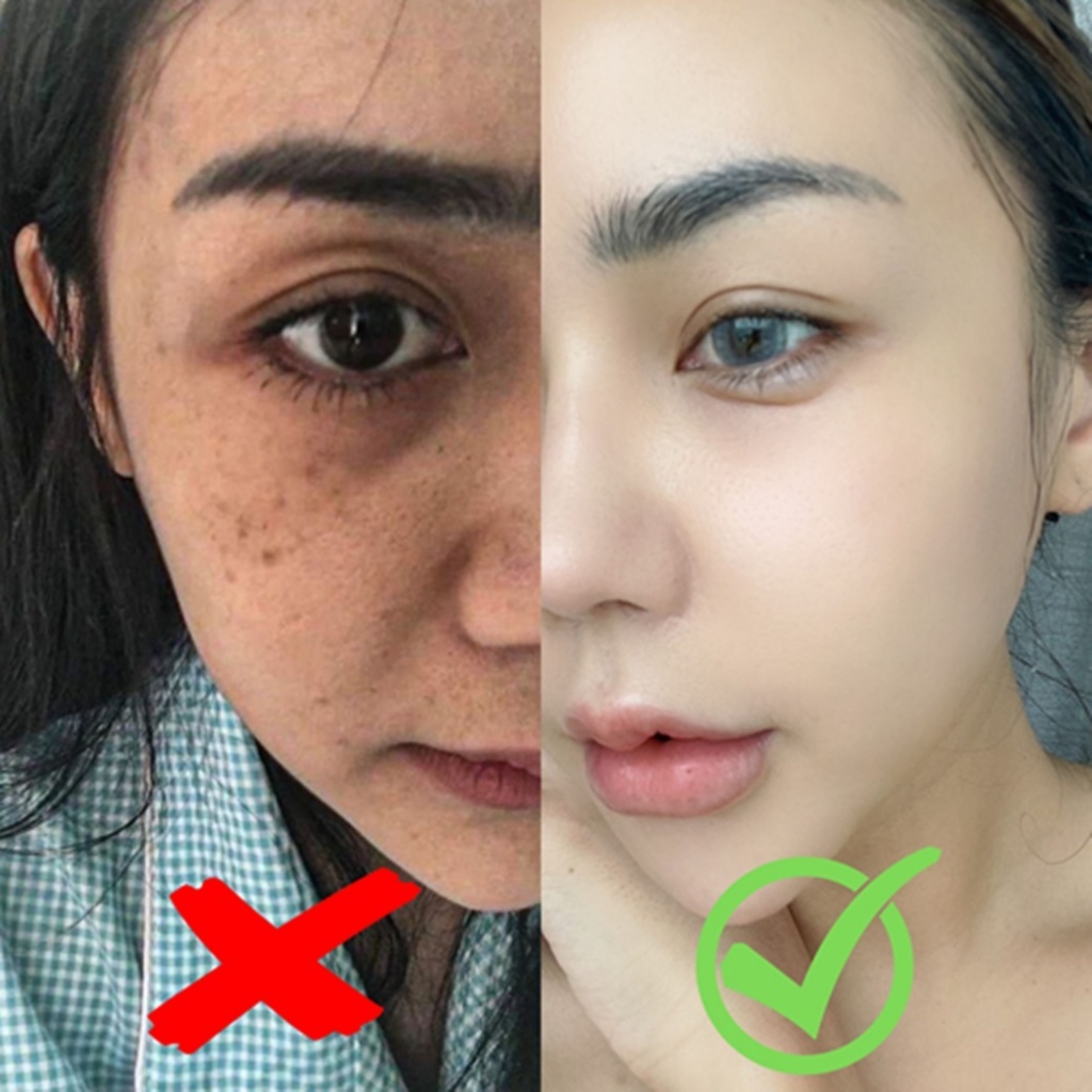 เซรั่มสดแก้ฝ้า Tranexamic Acid 3% + B3 5% ผิวกระจ่างใส ลดฝ้า กระ จุดด่างดำ เซรั่มลดฝ้ากระจุดด่างดํา Tranexamic acid — صورة 2