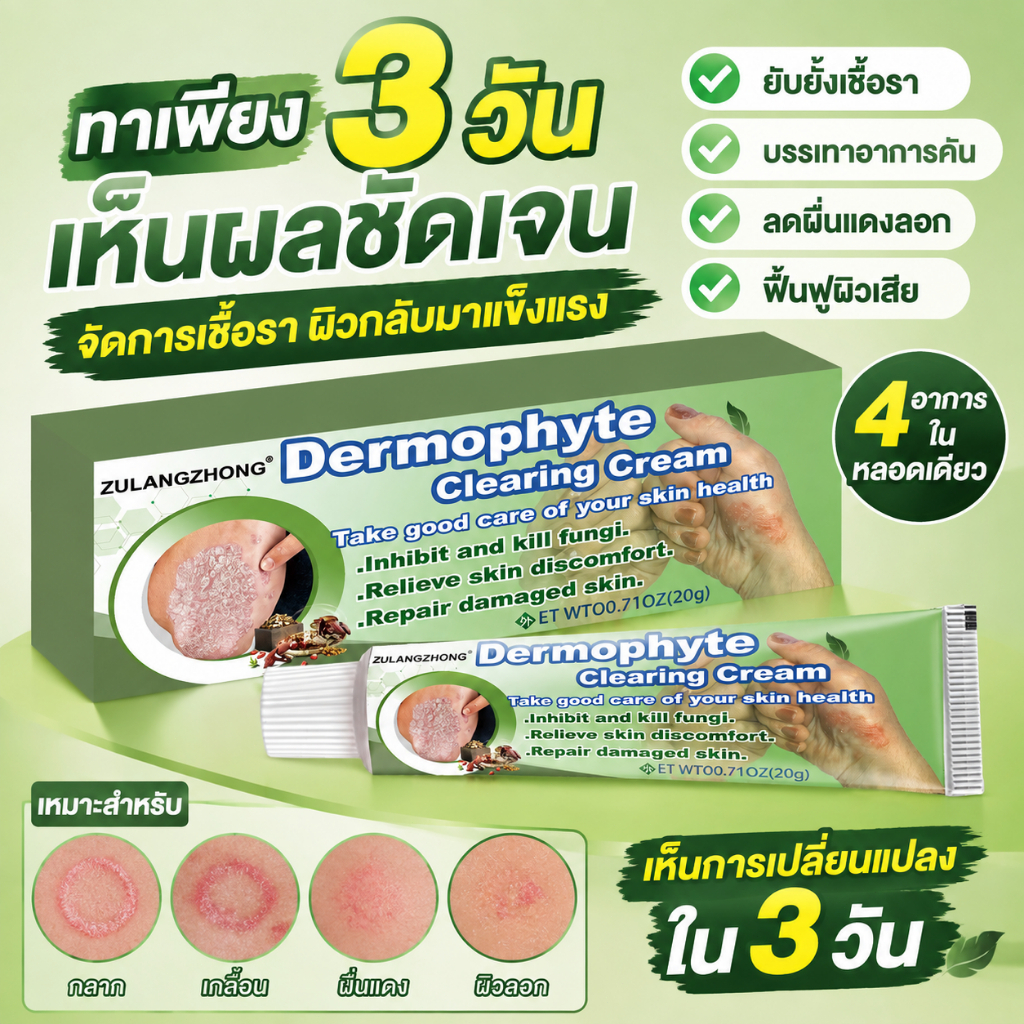 ครีมทาสังคัง สะเก็ดเงินครีม ครีมบำรุงผิว 20g รอยแดง โรคผิวหนัง เกลื้อน กลาก คัน สมุนไพร แก้คันเรื้อรัง คันในร่มผ้า