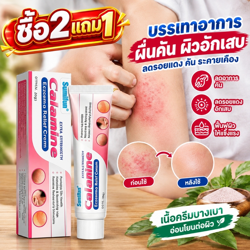 🔥ซื้อ2แถม1🔥ครีมแก้คันผิว ลดผื่นคัน ครีมผื่นแพ้ ครีมผิวหนังอักเสบ บรรเทาอาการคัน ฆ่าเชื้อรา ฟื้นฟูผิว 20G