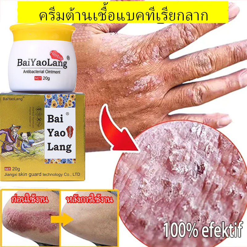 ครีมแก้คัน ครีมลดอาการคัน สะเก็ดเงินครีม โรคผิวหนัง เกลื้อน กลาก คัน สมุนไพร แก้คันเรื้อรัง คันในร่มผ้า 20g