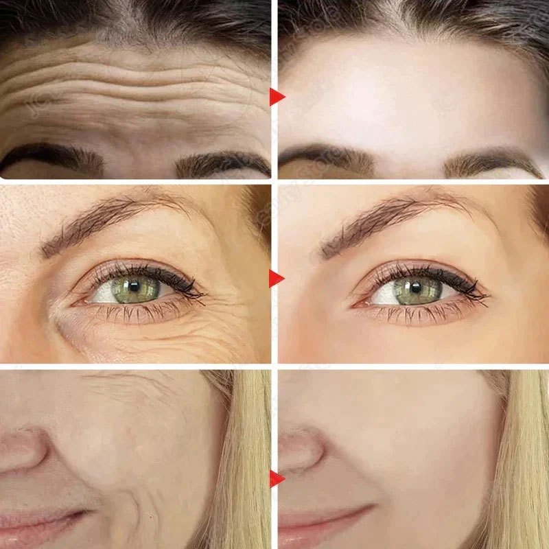 ครีม หน้า ขาว ครีมทาฝ้า ครีมแก้ฝ้า สารสกัดพืช 100% ขจัดฝ้า กระ จุดด่างดำ ลดริ้วรอย และให้ความชุ่มชื้นแก่ผิว - รูปที่ 2