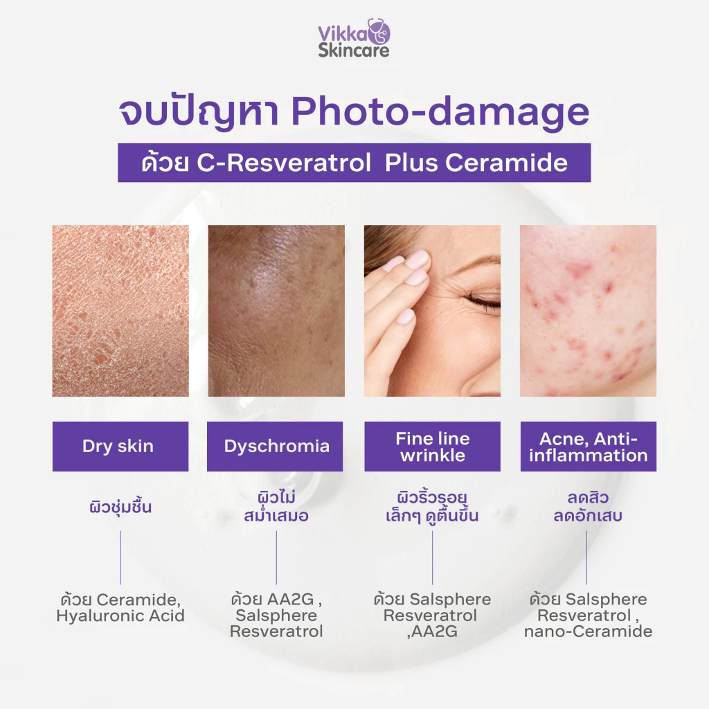 1 แถม 1 ในไลฟ์เท่านั้น! VIKKASKINCARE C'Resveratrol Plus Ceramide 30ml เซรั่มวิตามินซี องุ่นแดง ผิวกระจ่างใส ลดรอยดำ thumbnail 6