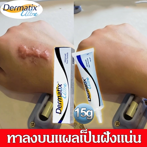 เจล:15g/9g/7g/5g丨ครีมทาแผลเป็น ครีมแผลเป็น เจลซ่อมแซม เจลรอยแผลเป็น รอยแผลเป็น รอยแผลเป็น แผลผ่าตัด น้ำร้อนลวก ครีม丨