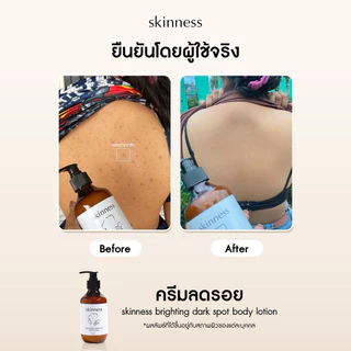 [พร้อมส่งทุกวัน] skinness brightening dark spot body lotion | ครีมลดรอยบำรุงผิวกายฝาดำ