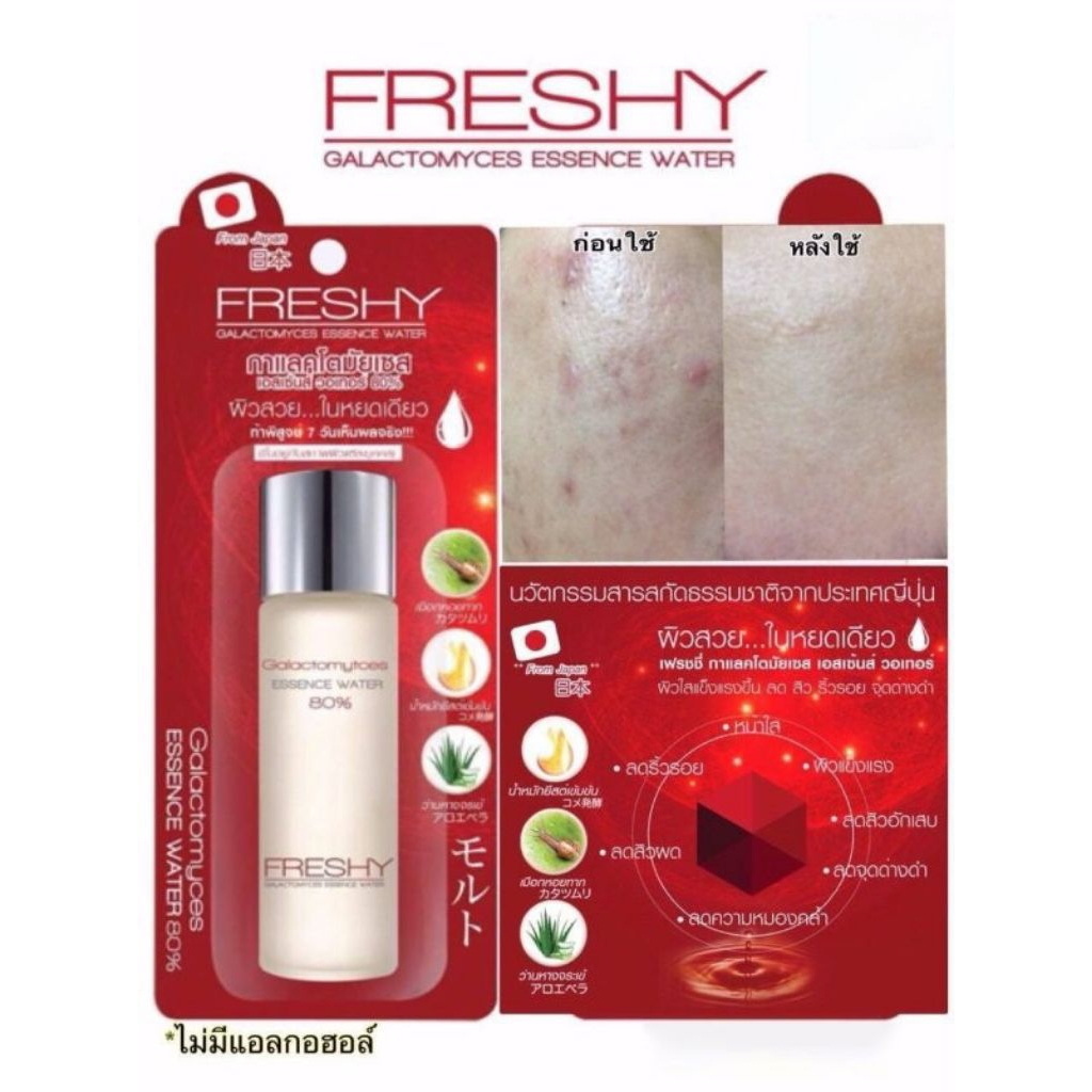 น้ำตบ Freshy Galactomyces Essence Water 80% ขนาด30m.l