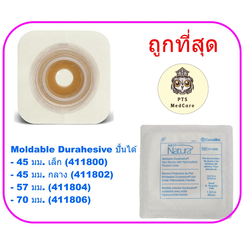 Convatec Flat Moldable แป้นแบบปั้นแต่งได้ แผ่นแป้นปิดรอบลำไส้ (Colostomy Flange) (ยกกล่อง 10 ชิ้น)