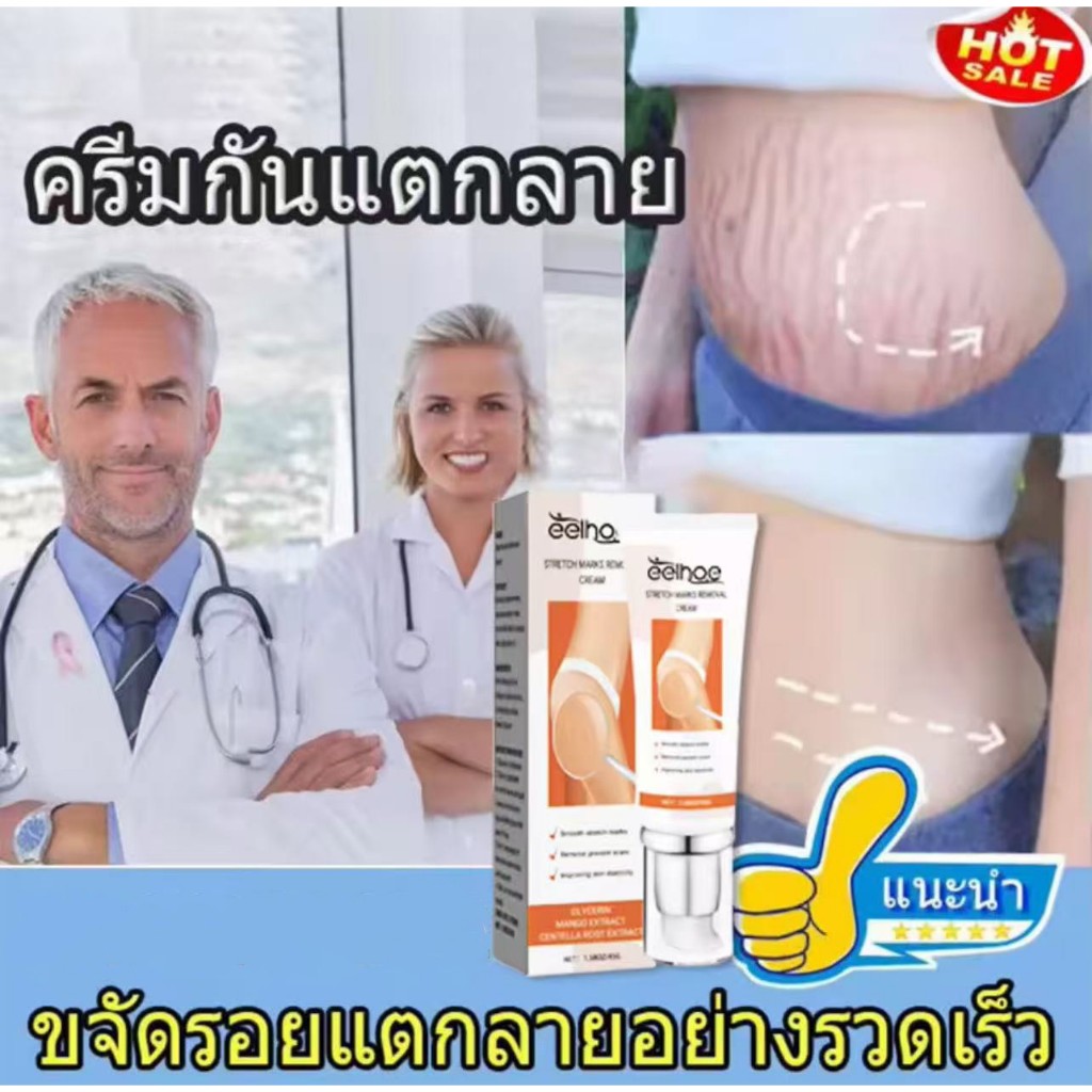 *4uh2xd4n6a* ครีมลดรอยแตกลาย  [45g] ลดเลือนรอยแผลเป็น ผิวแตกลาย ให้ดูจางลง