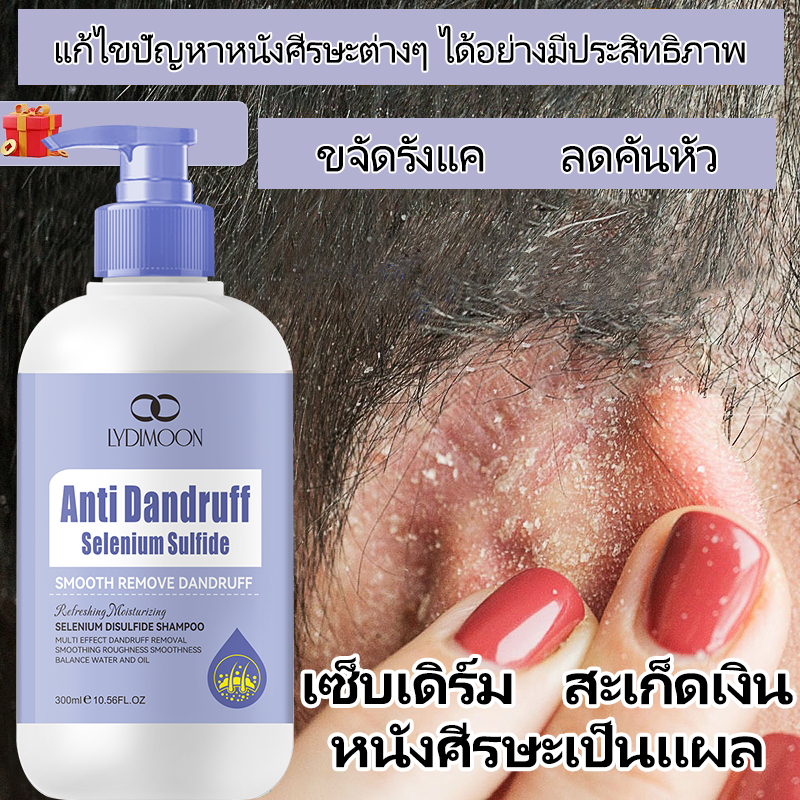 แชมพูขจัดรังแค แก้คัน ผมมัน 300ml สูตรลดเซบเดิร์ม