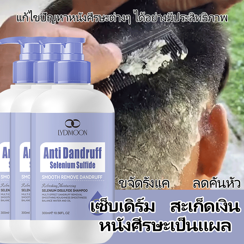 แชมพูแก้คัน ขจัดรังแค แชมพูผมมัน 300ml ลดเซบเดิร์ม ลดผมร่วง กลากเกลื้อน
