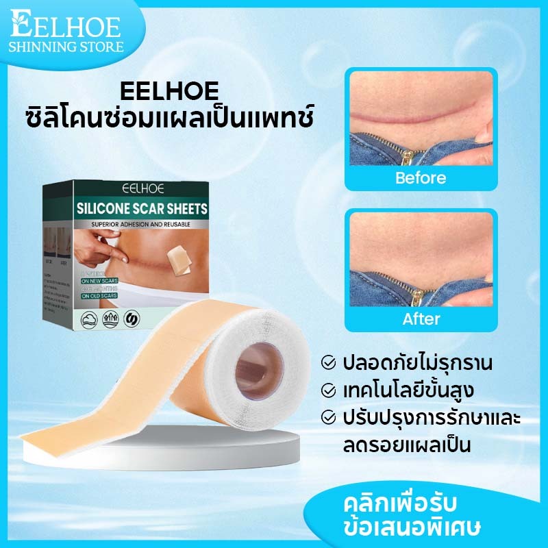 EELHOE แผ่นแปะแผลเป็น ซิลิโคนแปะแผลเป็น แผ่นซิลิโคนเจล รักษารอยแผลเป็น ลดรอยแผลเป็น  แปะลดรอยแผลเป็น