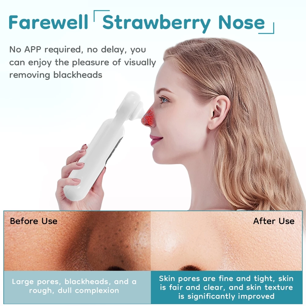 Airuidu BR04 Blackhead Remover เครื่องดูดสิวหัวดำแบบพกพาพร้อมไฟ LED กำลังขยาย 5 เท่า เหมาะสำหรับผู้หญิงและผู้ชาย thumbnail 7