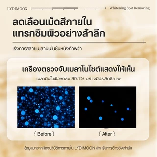 เซรั่มลดฝ้า กระ จุดด่างดํา เซรั่มลดฝ้า เซรั่มฝ้า 100ml กำจัดฝ้า จุดด่างดำ กระ ฝ้า ลบเมลานิน กระจ่างใสผิว แก้ฝ้าทุกชนิด
