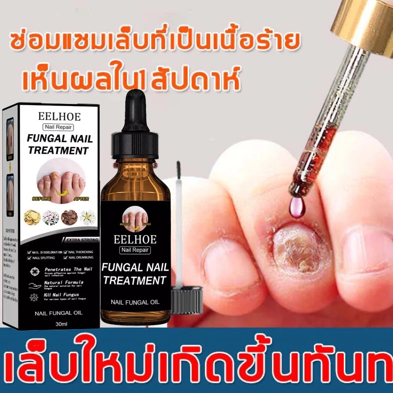 ส่งจากไทย* บำรุงเล็บ กำจัดเชื้อราเล็บ ทาเชื้อราเล็บ ฆ่าเชื้อราเล็บ กันเชื้อราเล็บ เชื้อราเล็บ เซรั่มบำรุงเล็บ