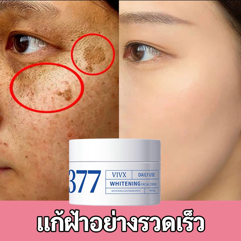 377ครีมบํารุงผิว ให้ผิวกระจ่างใสและเติมความชุ่มชื้นแก่ผิว