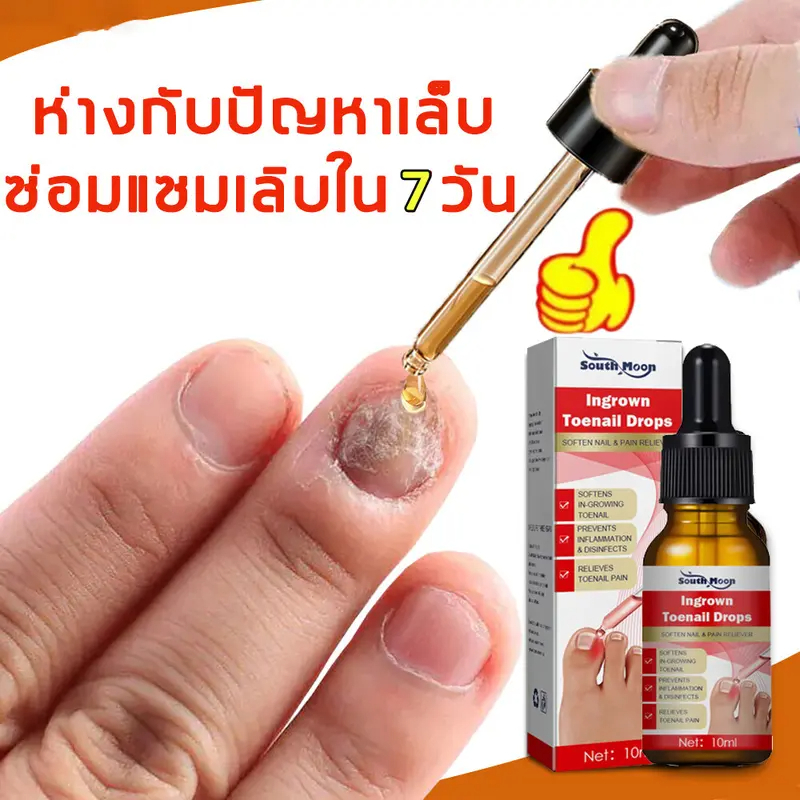 1ครั้งได้ผล กำจัดเล็บเสียได้เร็วเซรั่มทาเล็บเซรั่มรักษาเล็บ เล็บเท้าคุณภาพสูงกำจัดเชื้อราที่เล็บ เอ็สเซ็นซ่อมแซมเล็บเสีย