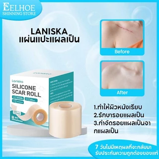 Laniska แผ่นแปะ ซิลิโคน ลดรอยแผลเป็น 4cm*150cm ซิลิโคนแปะแผลเป็น แปะแผลเป็น ลดรอยสิว แผลเป็นหลุม ไหมเย็บแผล แผลผ่าตัด