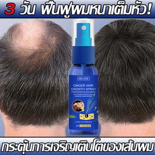 3 วัน ผมงอกเร็วทันใจ! EELHOE สเปรย์ปลูกผม ยาปลูกผมของแท้  กร…