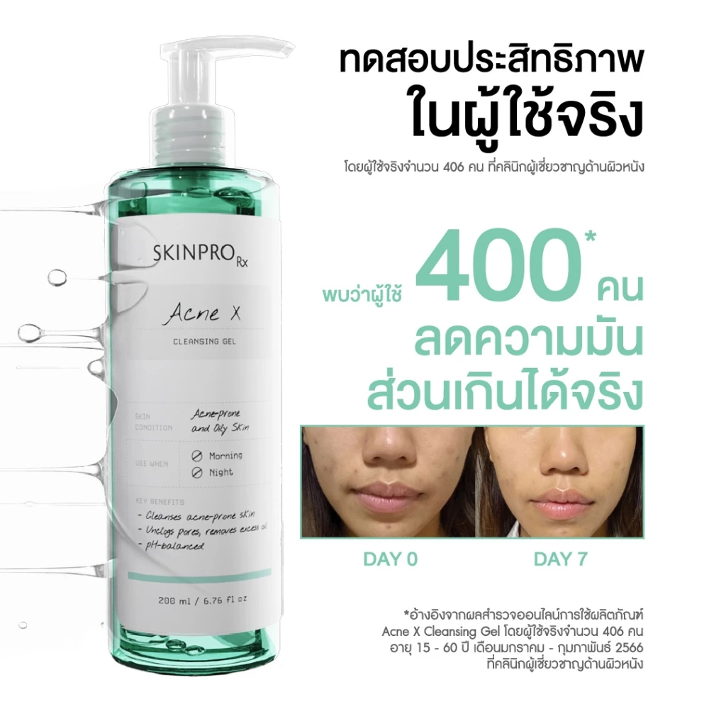 SKINPRO Rx Acne X Cleansing Gel คลีนซิ่งเจลสูตรสำหรับผิวมัน/เป็นสิว ลดการเกิดสิว ไซส์ใหญ่ 200ml. thumbnail 4