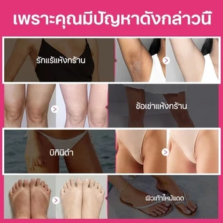ซื้อ 1 แถม 1 ครีมทาผิวขาว ครีมไวท์เทนนิ่ง ครีมบำรุงรักแร้ 10 วันเห็นผล ครีมขาหนีบดำ ครีมหัวนมชมพู ทาที่ลับขาว ลบเมลานิน