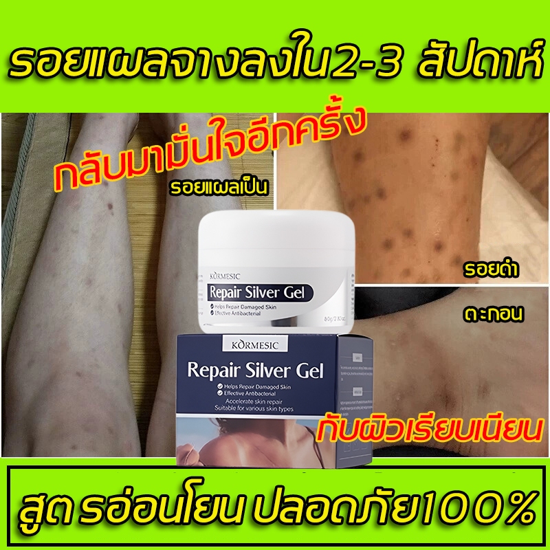 💯ครีมแผลเป็น ครีมลดรอยแผลเป็น 50g ครีมทาแผลเป็น ยาทาแผลเป็น น้ำร้อนลวก แผลเป็นนูนหนา แผลเป็นถลอก เร่งการซ่อมแซมให้ผิว