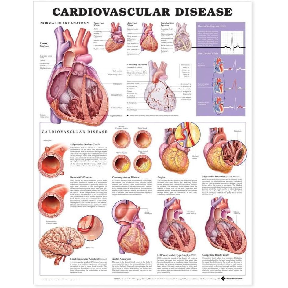 แผ่นโปสเตอร์ Cardiovascular Disease Anatomical Chart (Paper) ed 2/2004