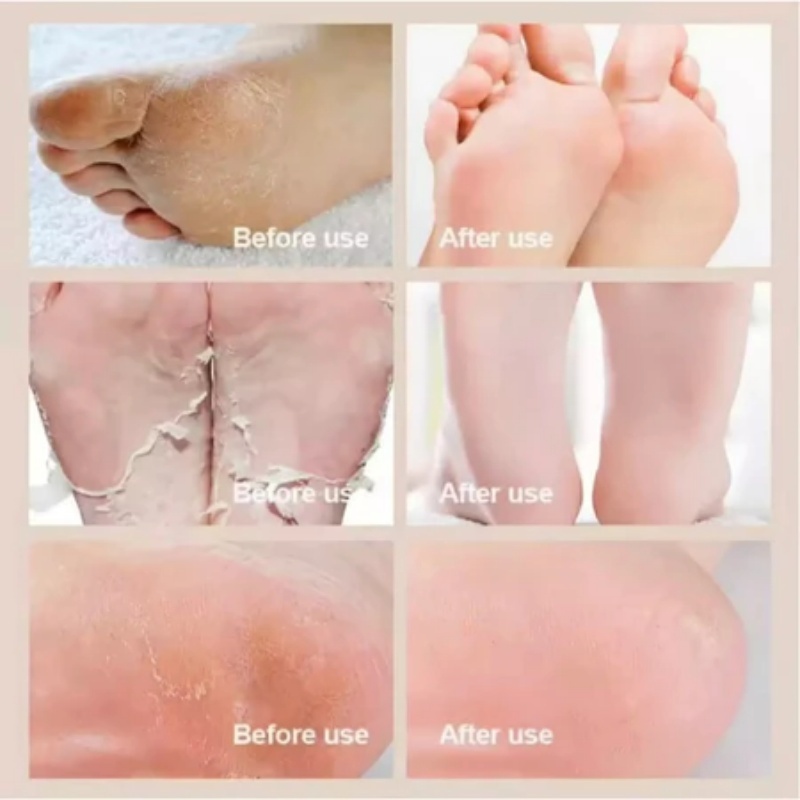 น้ำมันม้า 120g บำรุงมือและเท้า ช่วยแก้ปัญหากลิ่นเท้า เท้าคัน เท้าแตก ผิวลอก เพื่อให้มือและเท้าไม่แห้งแตก และ - รูปที่ 2