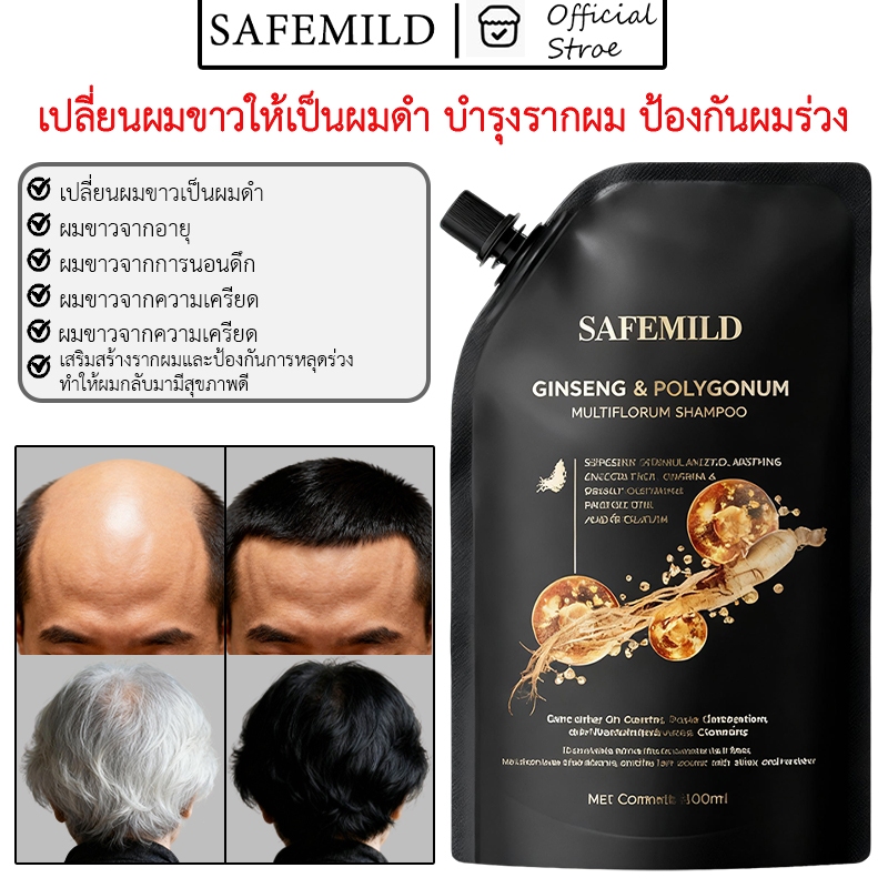 แชมพูSAFEMILD มีส่วนผสมของสมุนไพร บำรุงรากผม ป้องกันผมร่วง ส่งเสริมการเจริญเติบโตของเส้นผมใหม่ 300มล