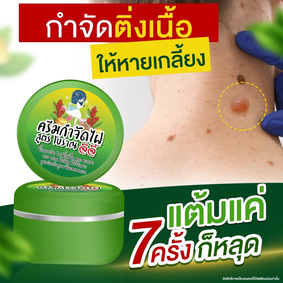 ครีมไฝจีจี้ ขี้แมลงวัน ติ่งเนื้อ หูด ตาปลา แก้ปัญหา กระ สิวหิน ครีมแต้มไฝจีจี้ไฝ หูด จี้ไฝ แต้มไฝ หูดติ่งเนื้อ