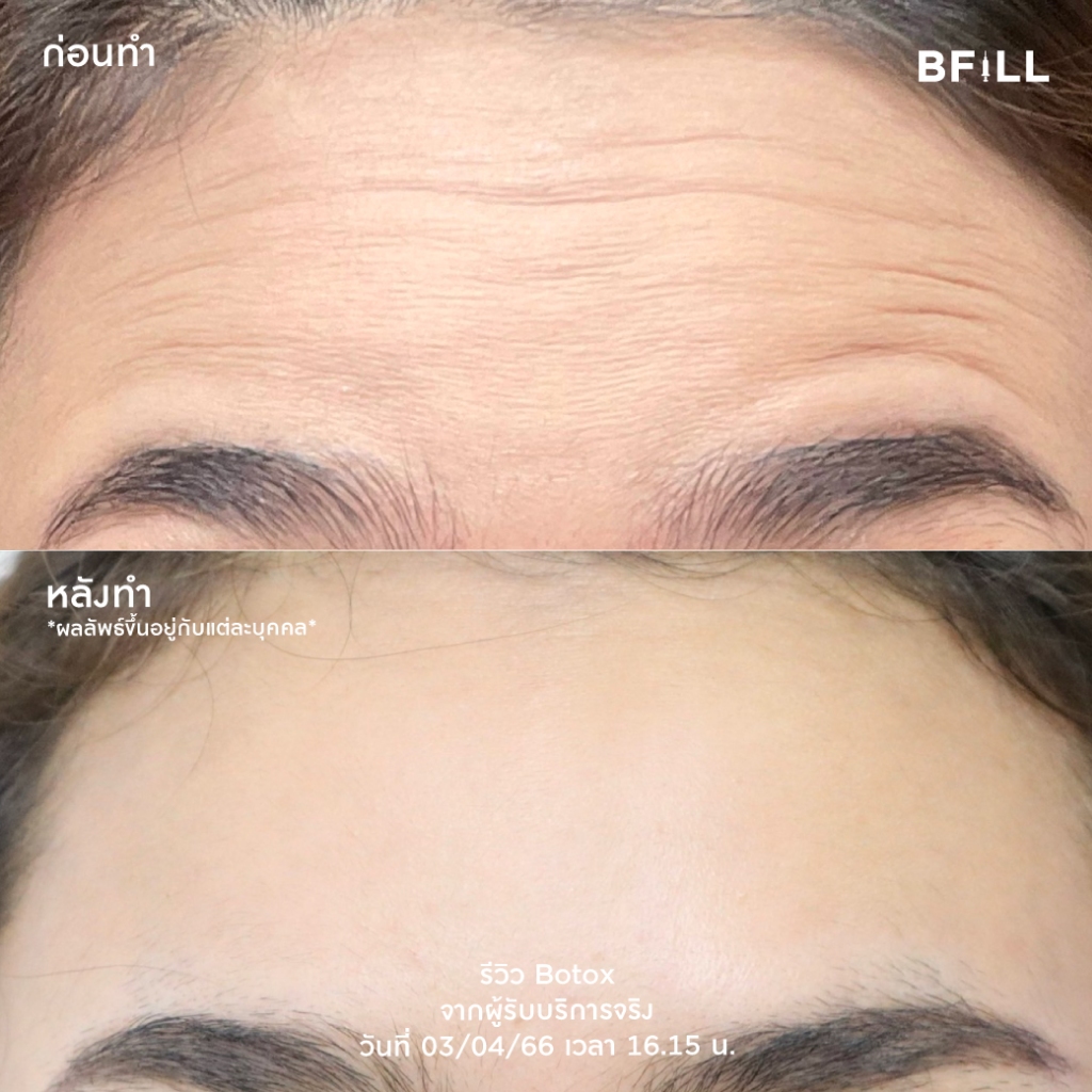 รูปภาพ 4