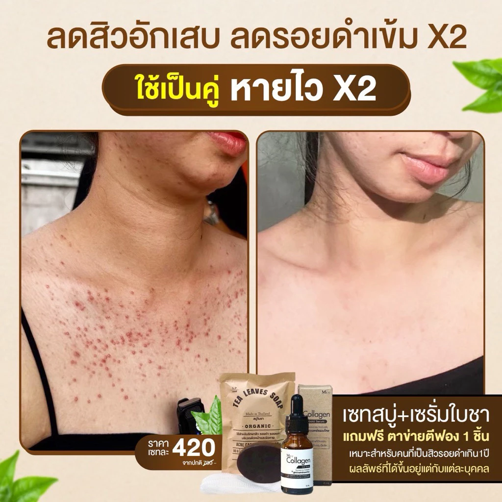 เซ็ท2ชิ้นสบู่ใบชา+เซรั่มใบชา สูตรแพทย์แผนไทย แถมตาข่ายตีฟอง