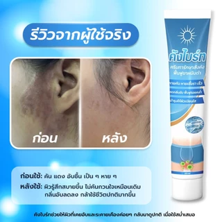 คังไบร์ท ซูธติ้งครีม ดูแลผิวระคายเคือง