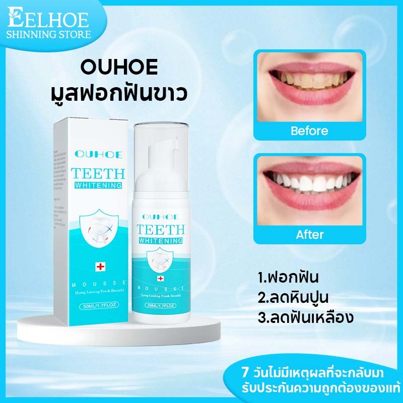 【1 แถม 1】OUHOE มูสทําความสะอาดฟัน ยาสีฟันฟันขาว ฟอกฟัน ลดฟันเหลือง ลดหินปูน บรรเทาเหงือก ลดกลิ่นปาก