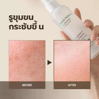 [Blanc Nature] Acne & Pore Removal Toner โทนเนอร์ลดสิว กระชับรูขุมขน ซิก้าออร์แกนิก 88%, AHA, BHA