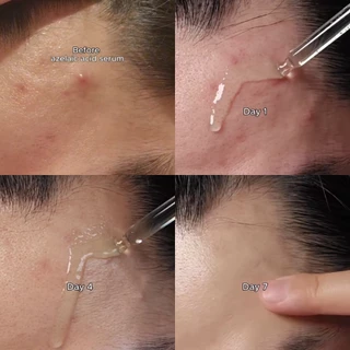รวมเซรั่ม Azelaic Acid 10 Hyaluron/ PDRN Hyaluronic Acid Capsule 100/ Niacinamide 10% + TXA 4%