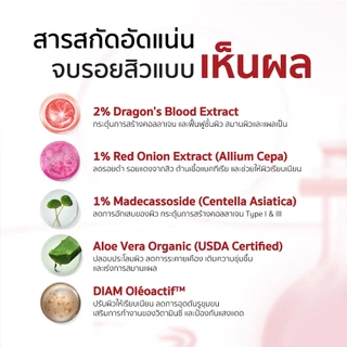 [แพ็กคู่สุดคุ้ม] ES X-roy Scar Gel 10g เจลลดรอยสิว รอยแดง รอยดำ รอยแผลเป็นจากสิว