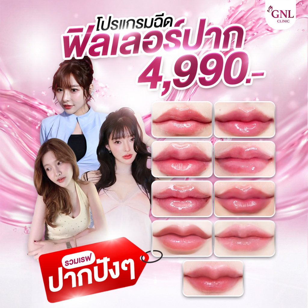 โปรแกรม Filler ปาก ปากสวยอิ่มฟู ลิปไม่ตกร่อง GNL CLINIC